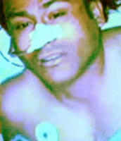 Abu Zubaida injured, shortly after his arrest. (Note: this picture is from a video presentation on prisoners the Pakistani government gave to BBC filmmakers. It has been adjusted to remove some blue tinge.)